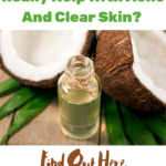 Can coconut oil REALLY help with acne and clear skin?