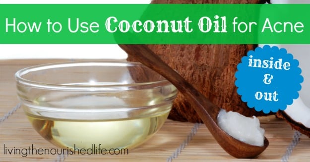 Can coconut oil REALLY help with acne and clear skin?