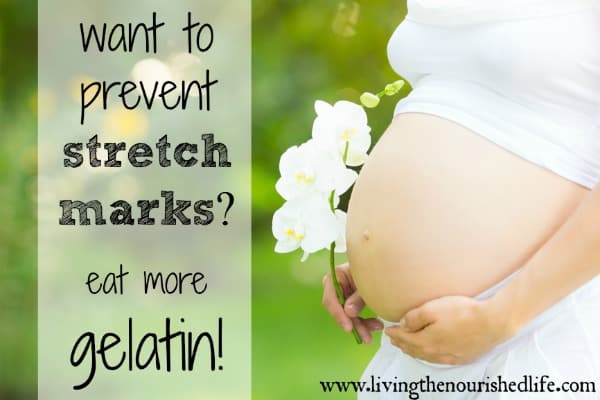 Want to Prevent Stretch Marks? Eat More Gelatin! Pregnant Woman in White with white flowers